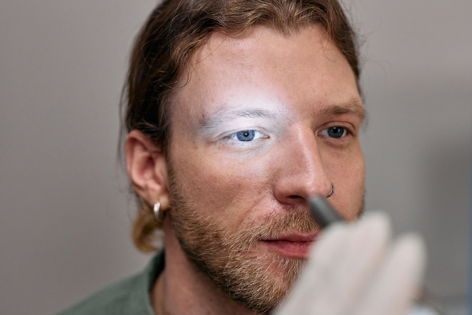 Tear Duct Obstruction (DSR) Treatment in Turkey