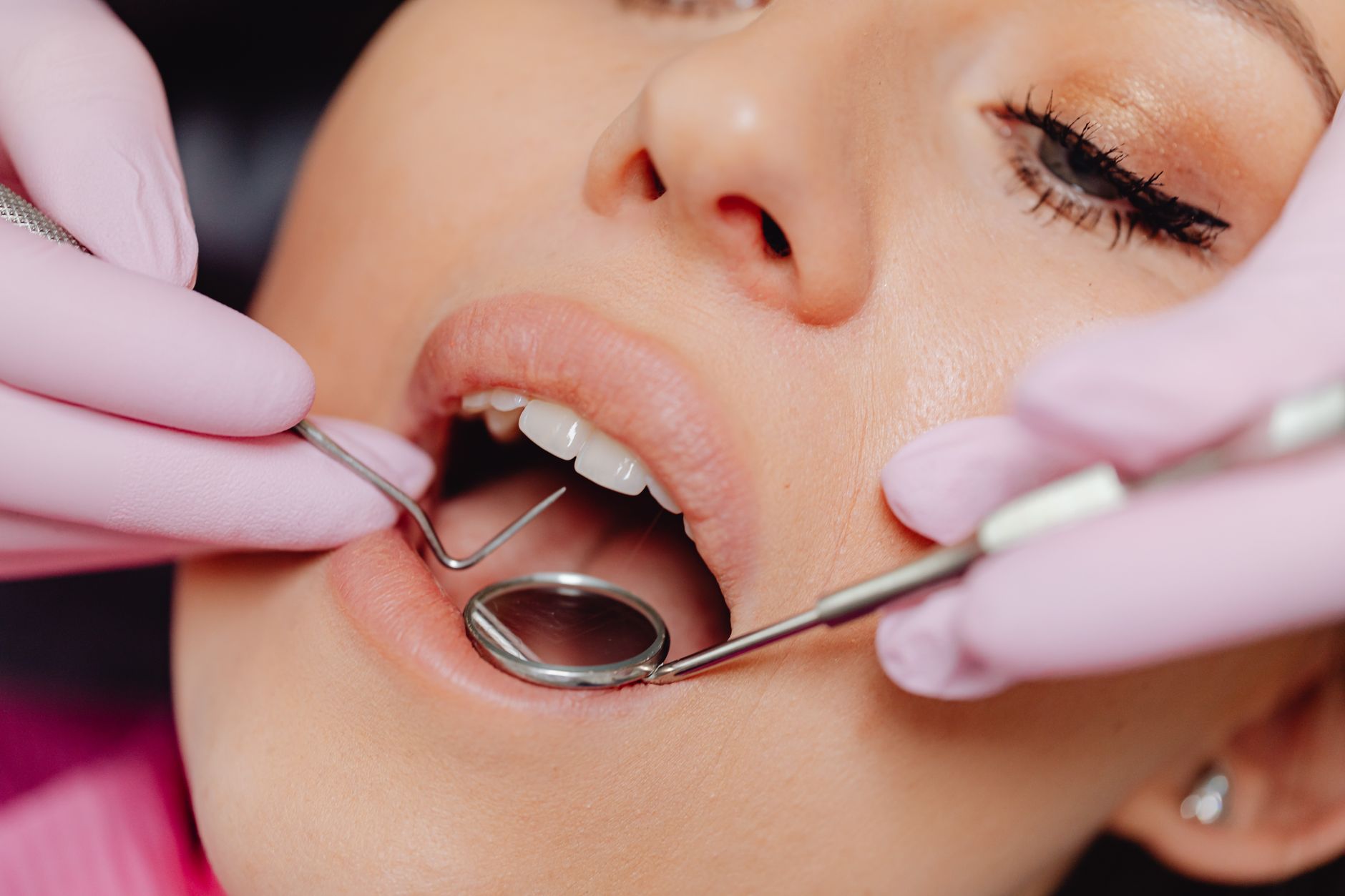 Gingivitis Treatment and Professional Care Packages in Turkey