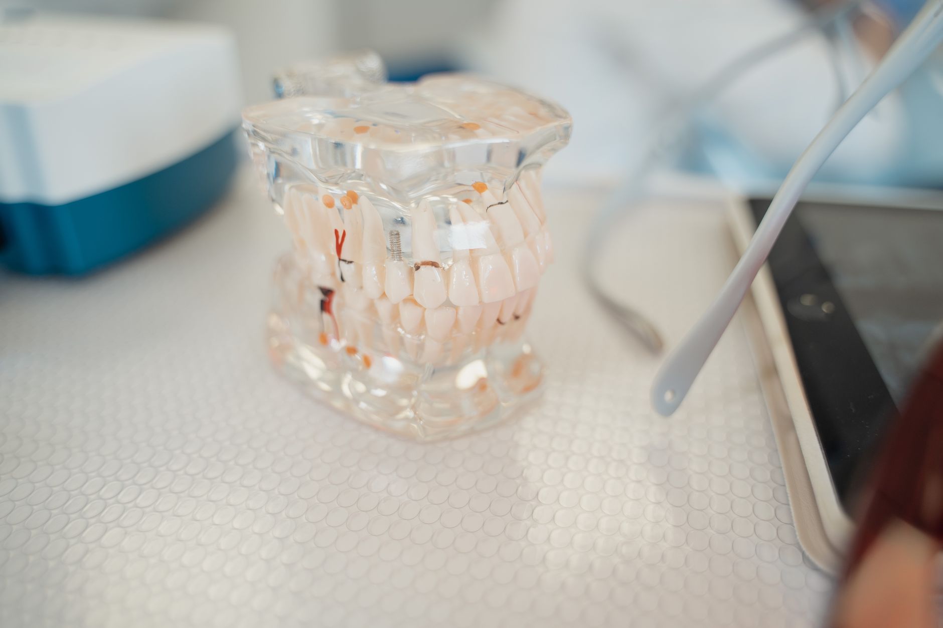 Peri-Implantitis Treatment and Tissue Preservation Packages