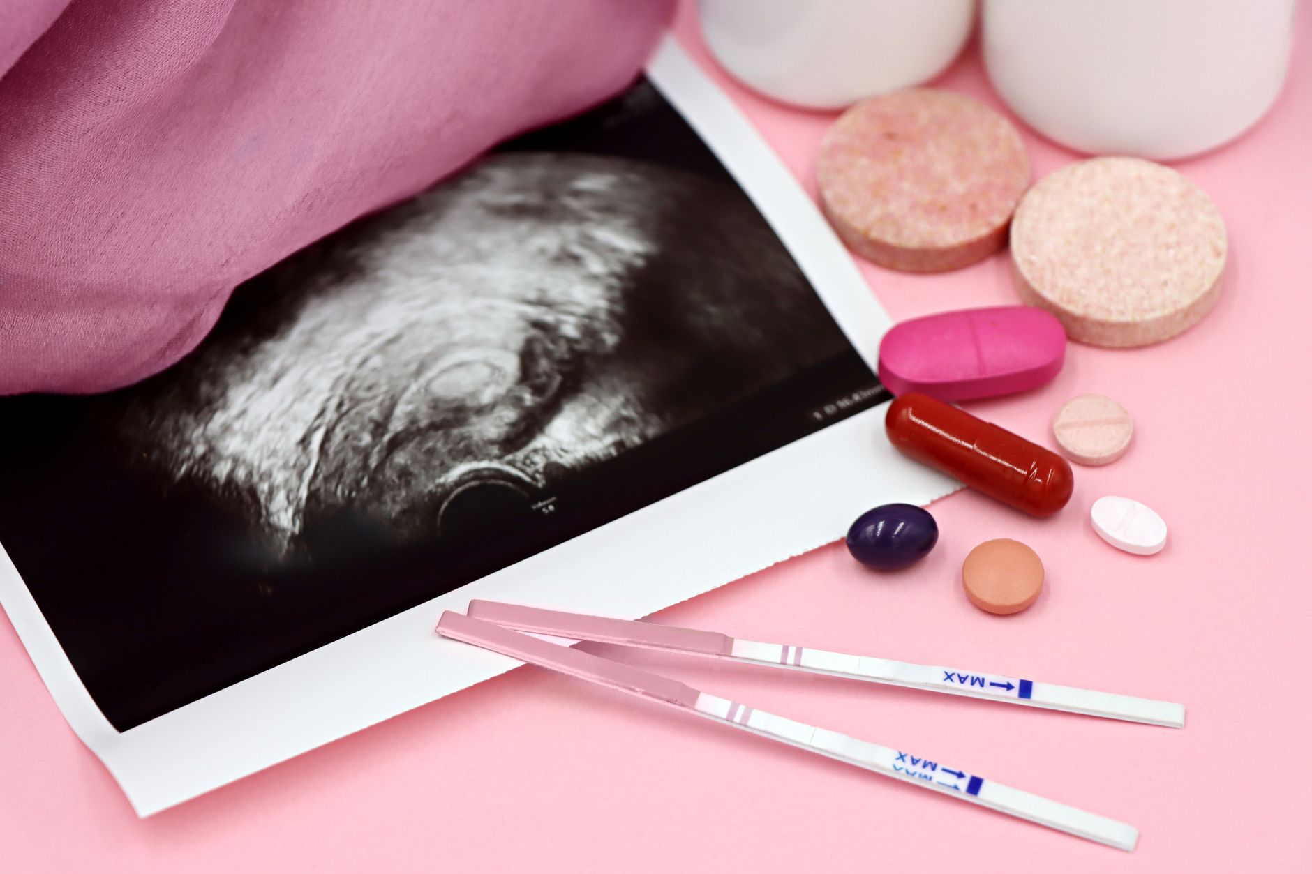 Türkiye’de PKOS ve Hormonal Yönetim Paketleri