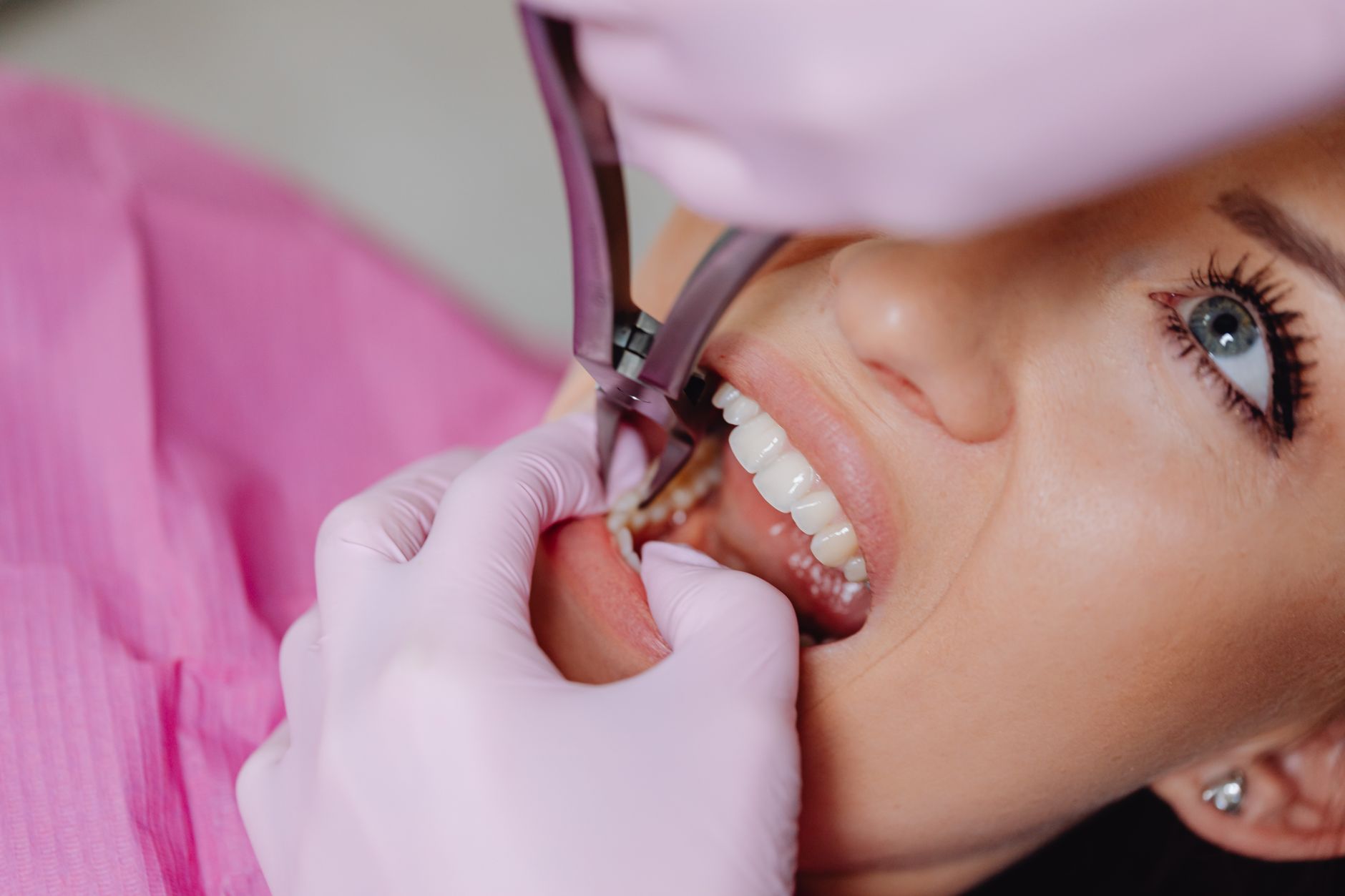 Does Tooth Filing Cause Permanent Damage?
