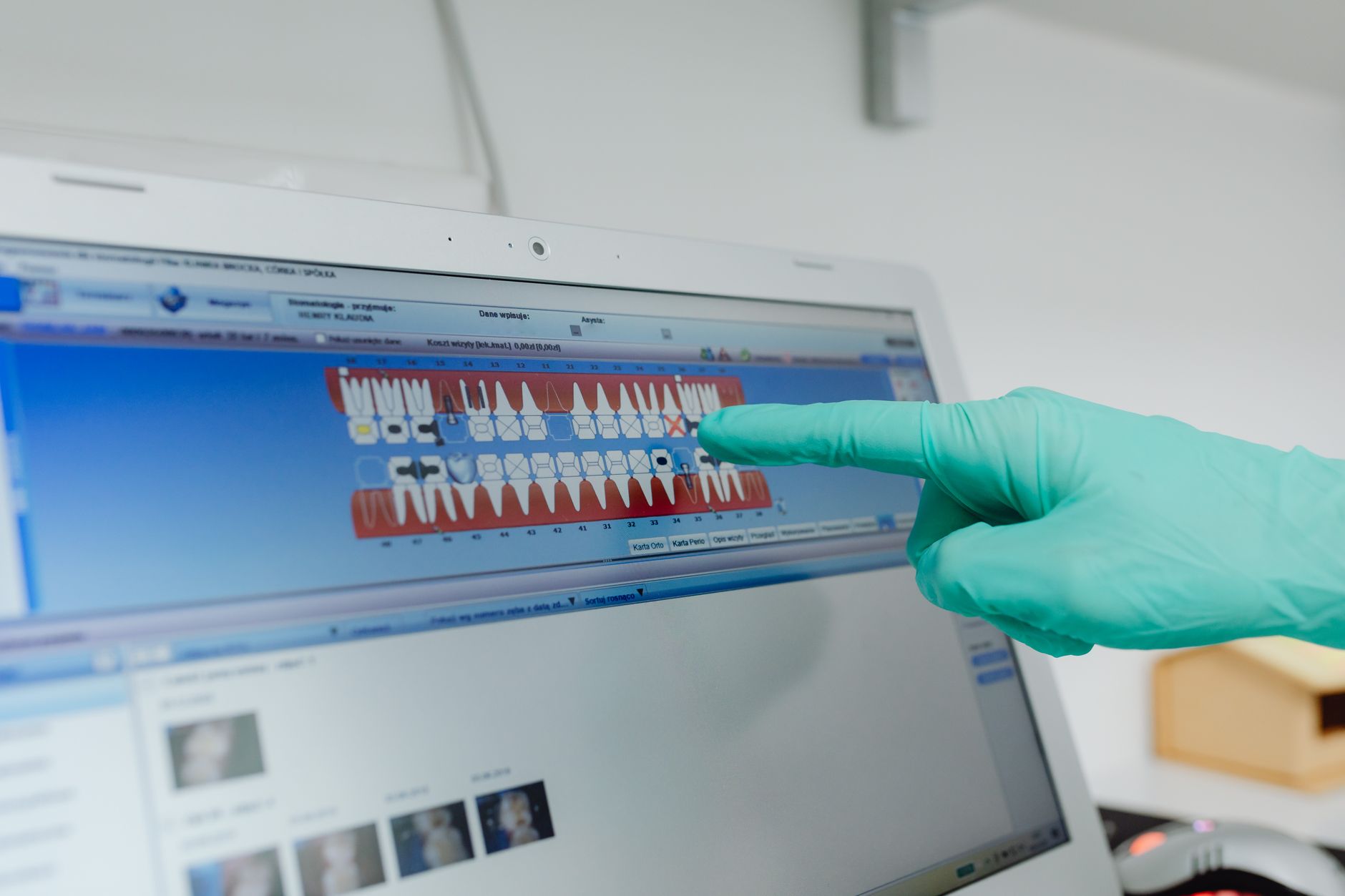 İstanbul’da Lüks Diş Kliniklerinde 3D CAD/CAM Teknolojisi