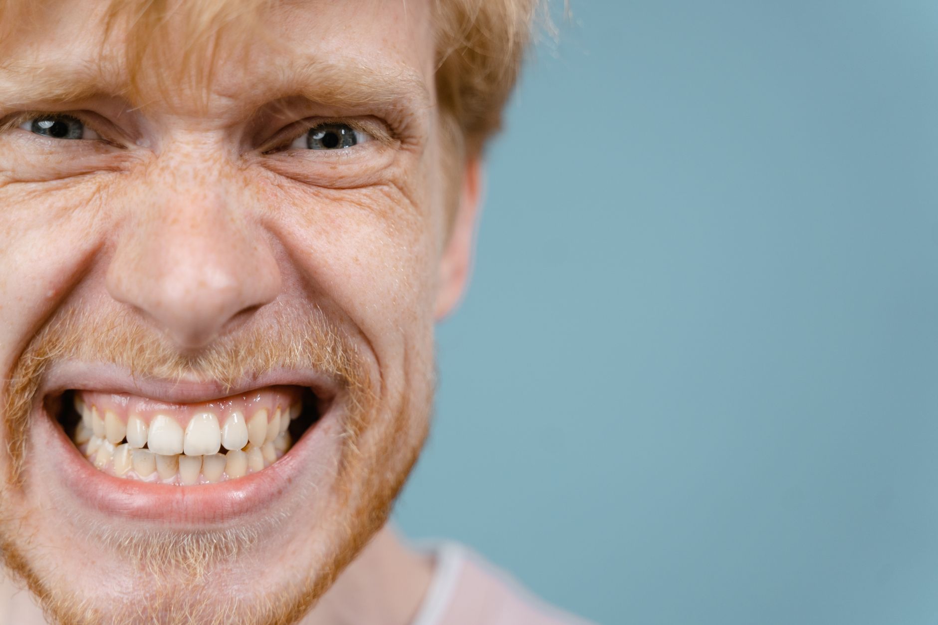 Le Hollywood Smile est-il possible en cas de bruxisme ?