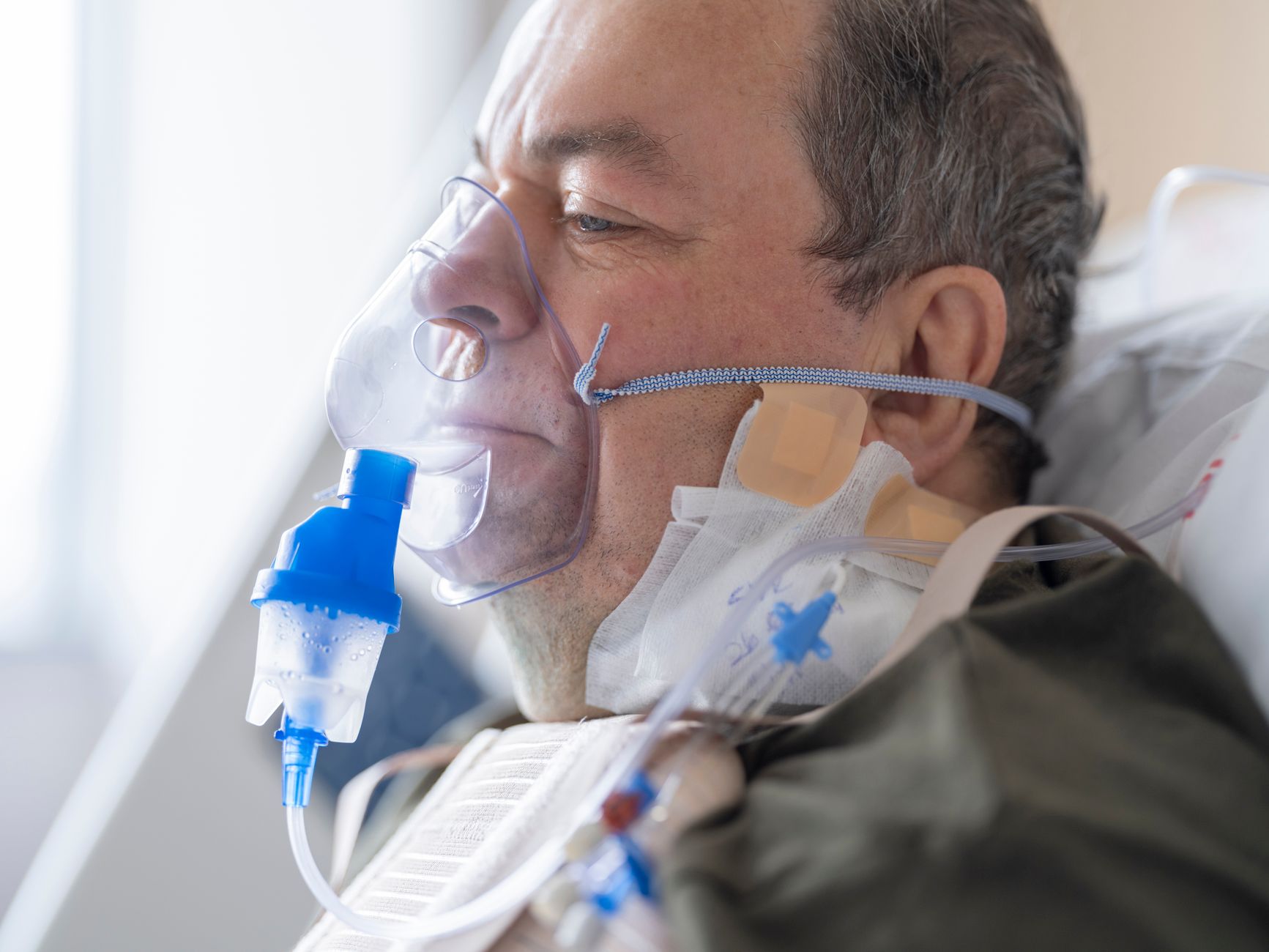 Traitement de l’intoxication au monoxyde de carbone et oxygène hyperbare